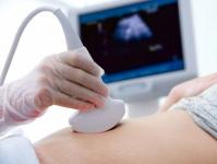 O que são miomas uterinos - causas, sinais, tratamento