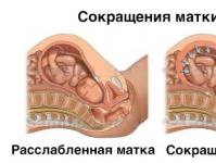 Tônus uterino durante a gravidez - causas, sintomas e tratamento Causas do tônus ​​uterino no início da gravidez
